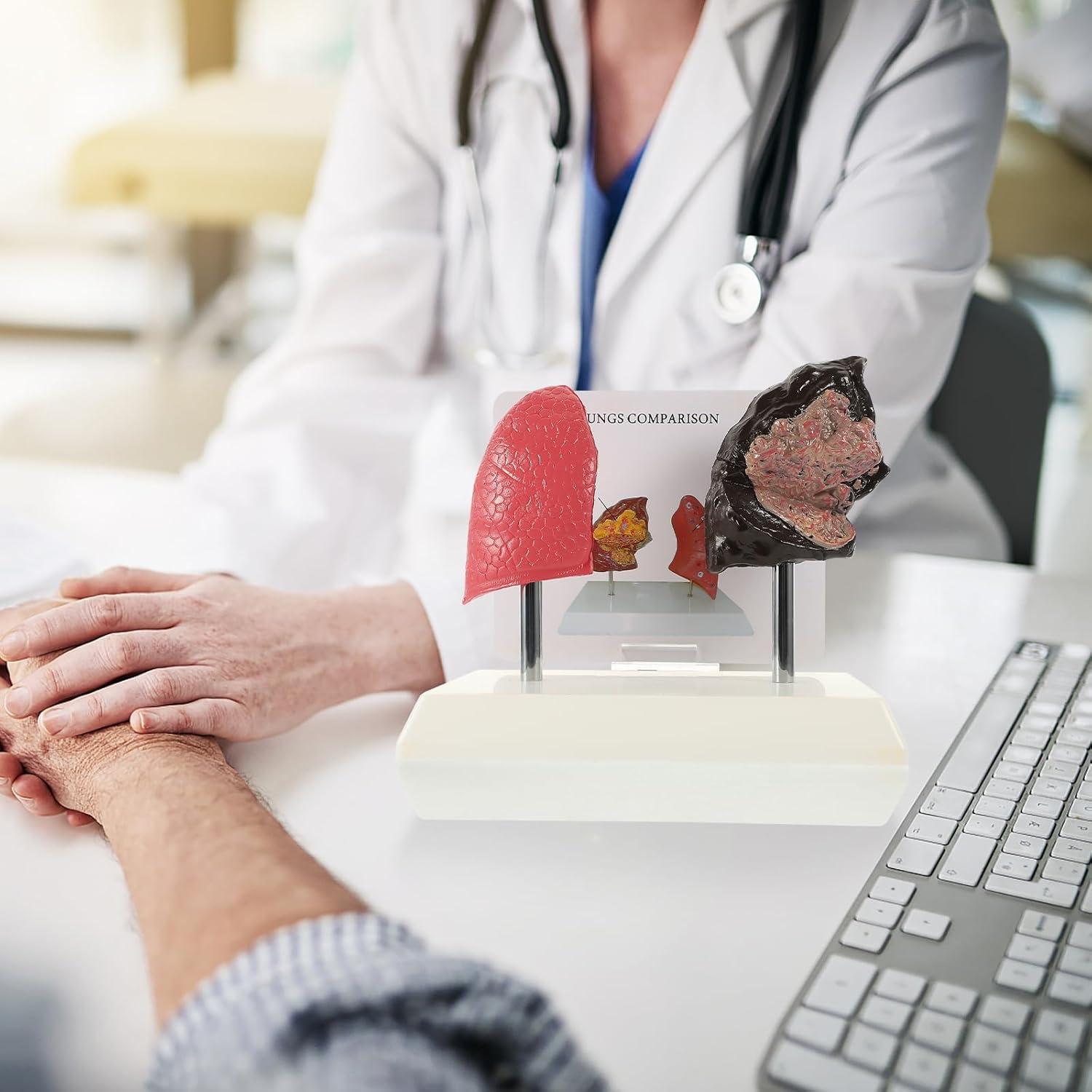 Molde de Estructura Pulmonar Healvian 1:1 PVC Educativo