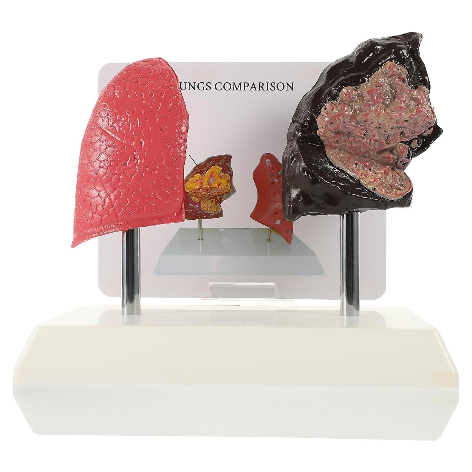 Modelo de Pulmón Hemoton 1:1 para Enseñanza de Salud