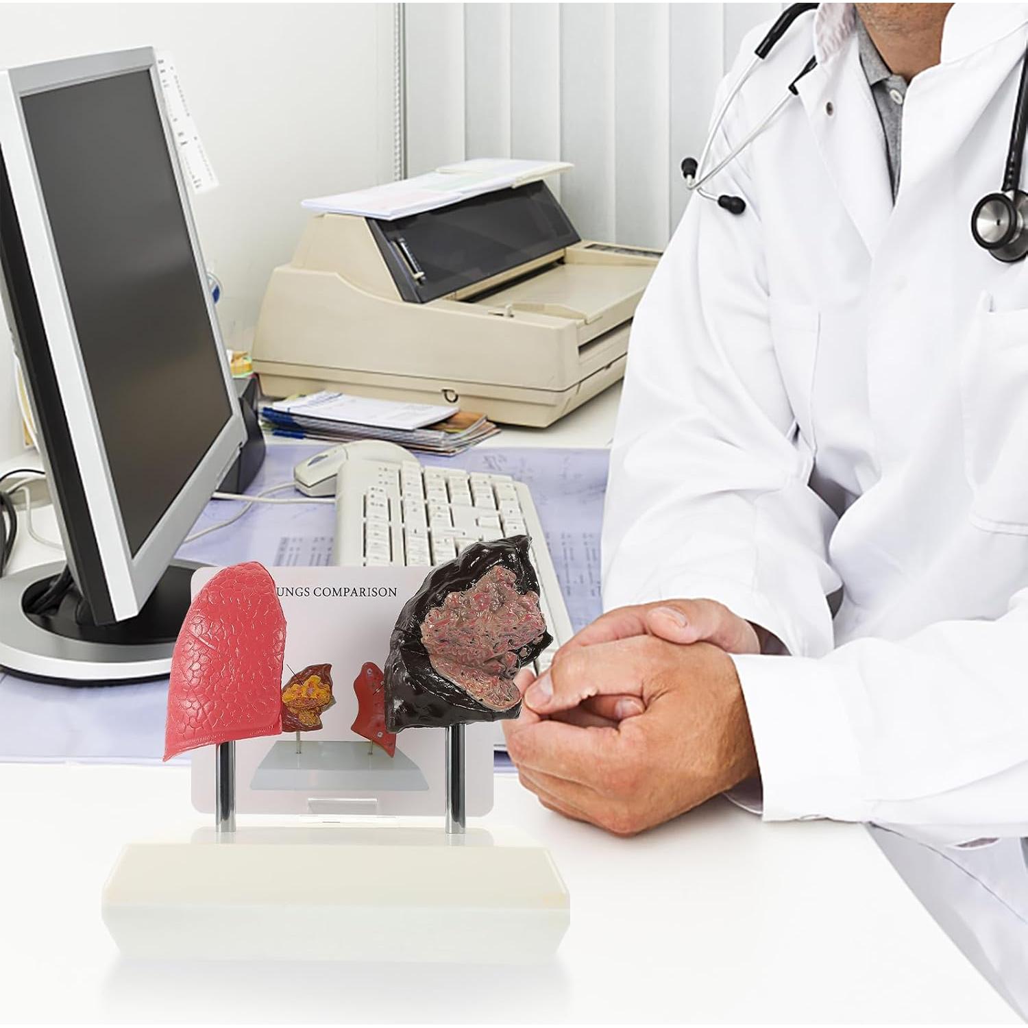 Modelo de Pulmón Hemoton 1:1 para Enseñanza de Salud