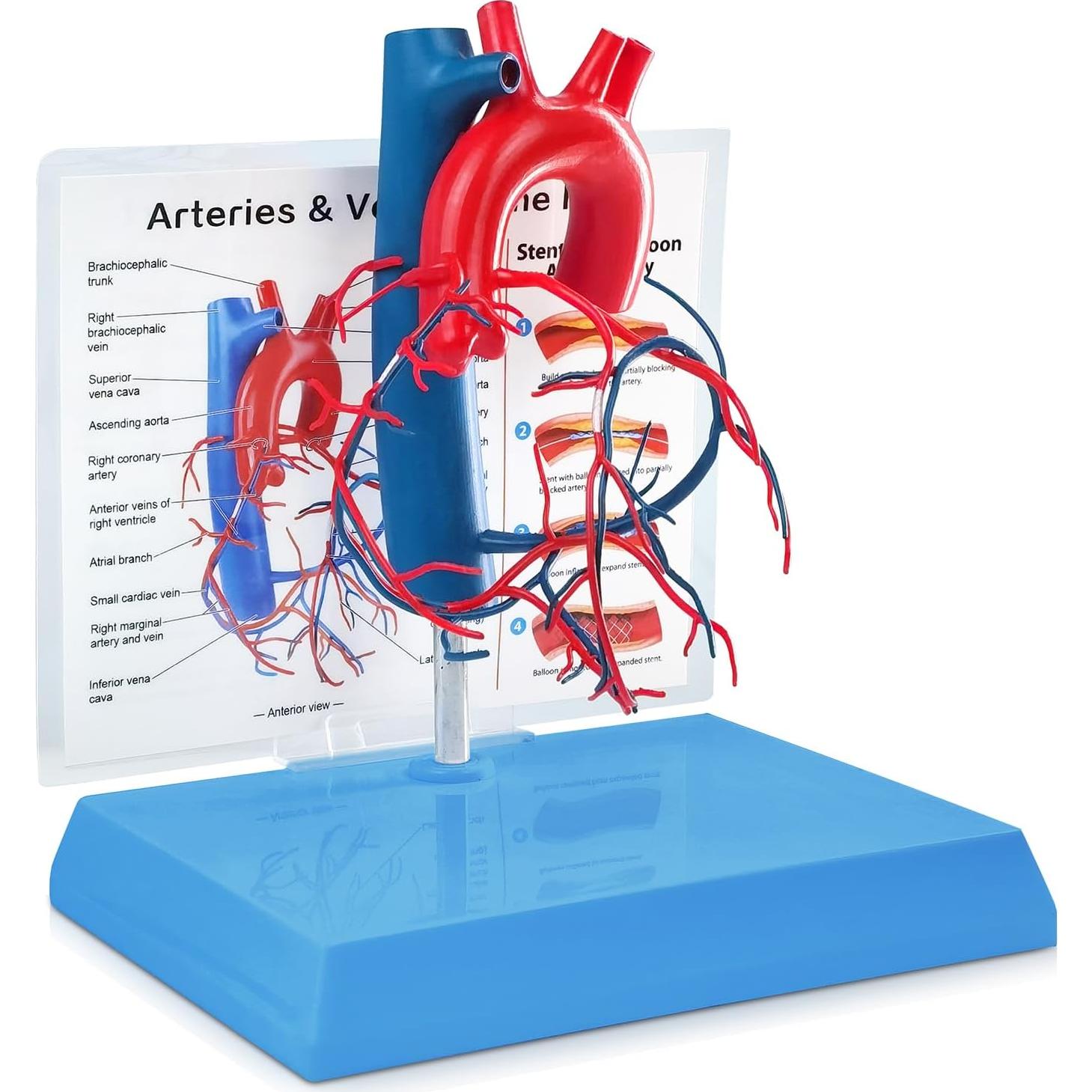 Modelo de Corazón Humano New Horizon 19.8x14.7 cm con Venas