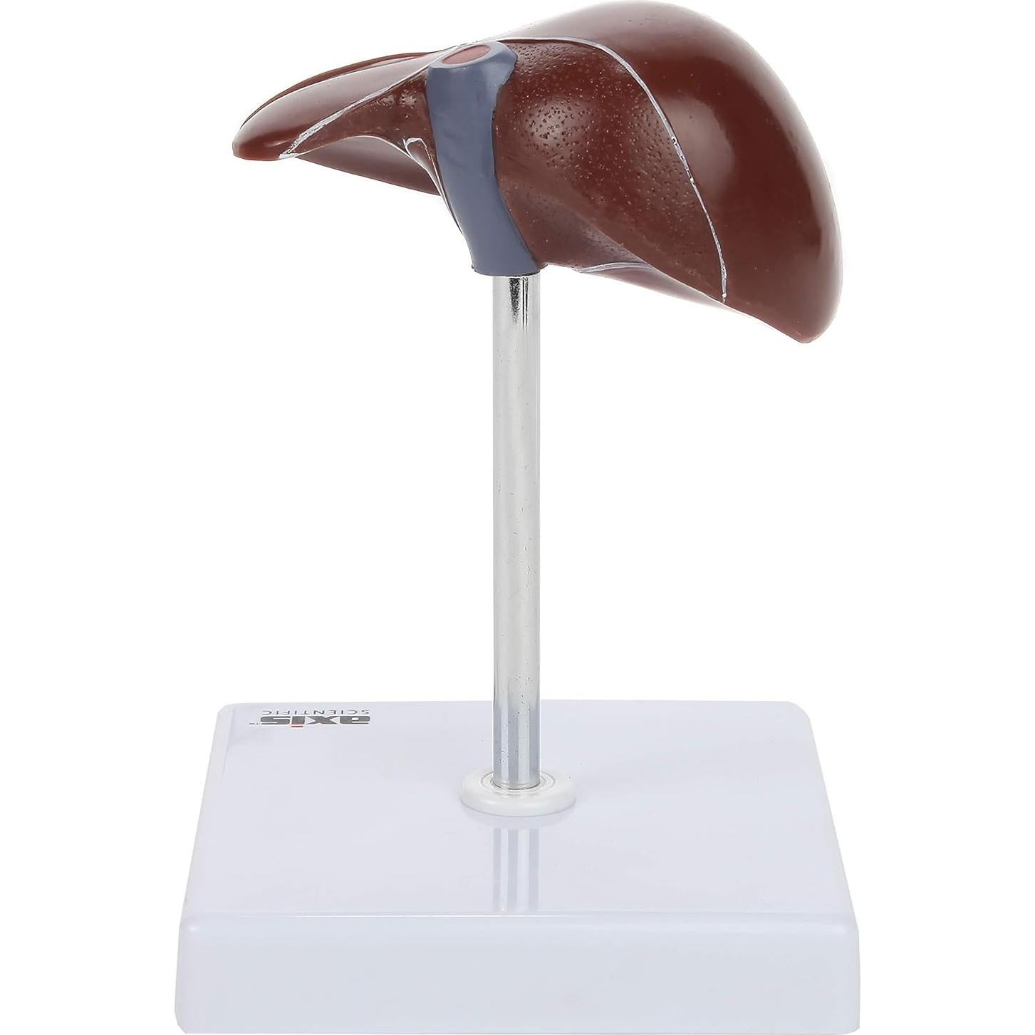 Axis Scientific Anatomy Model of Diseased Liver | Model is 1/3 Life-Size and Divides in 2 Parts | Shows 6 Liver Diseases and Abnormalities | Comes on a White Base