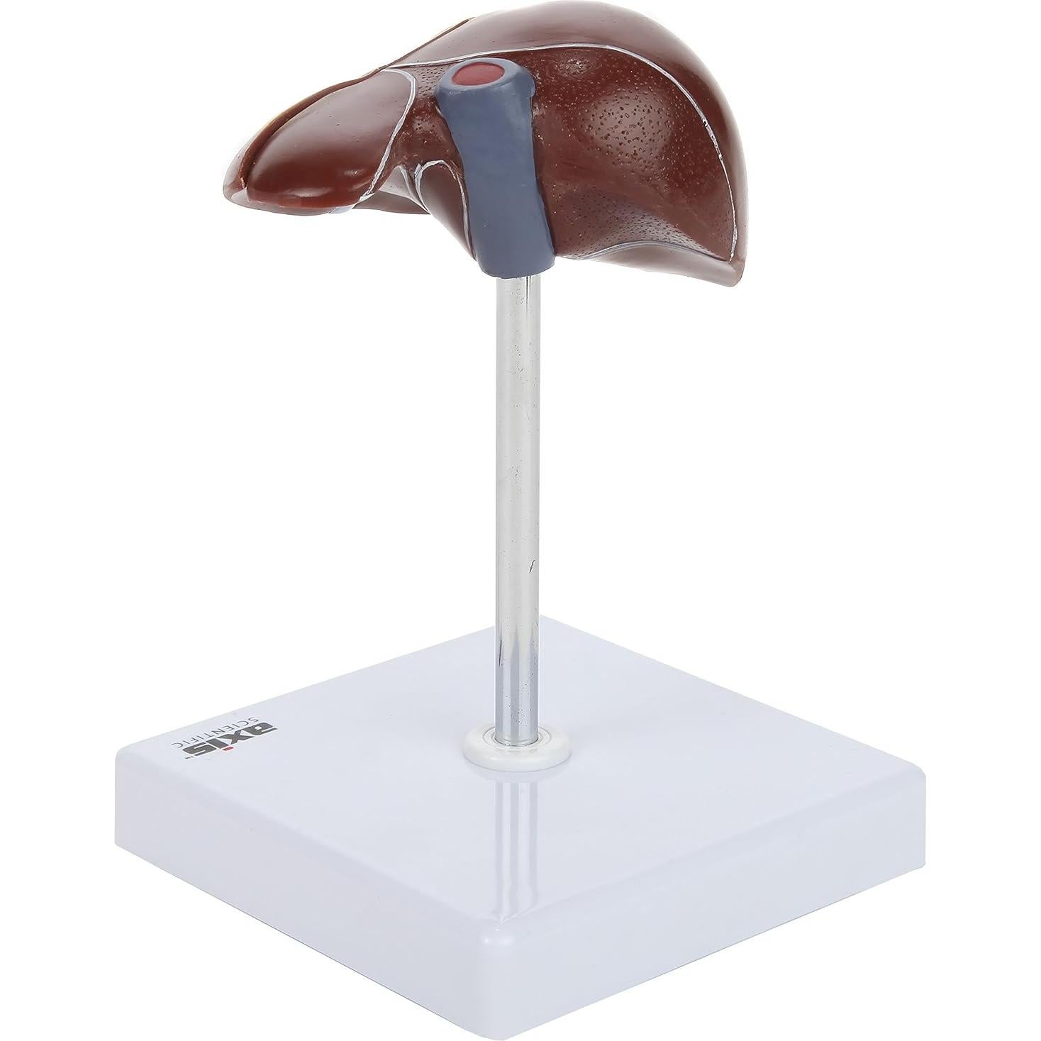 Axis Scientific Anatomy Model of Diseased Liver | Model is 1/3 Life-Size and Divides in 2 Parts | Shows 6 Liver Diseases and Abnormalities | Comes on a White Base