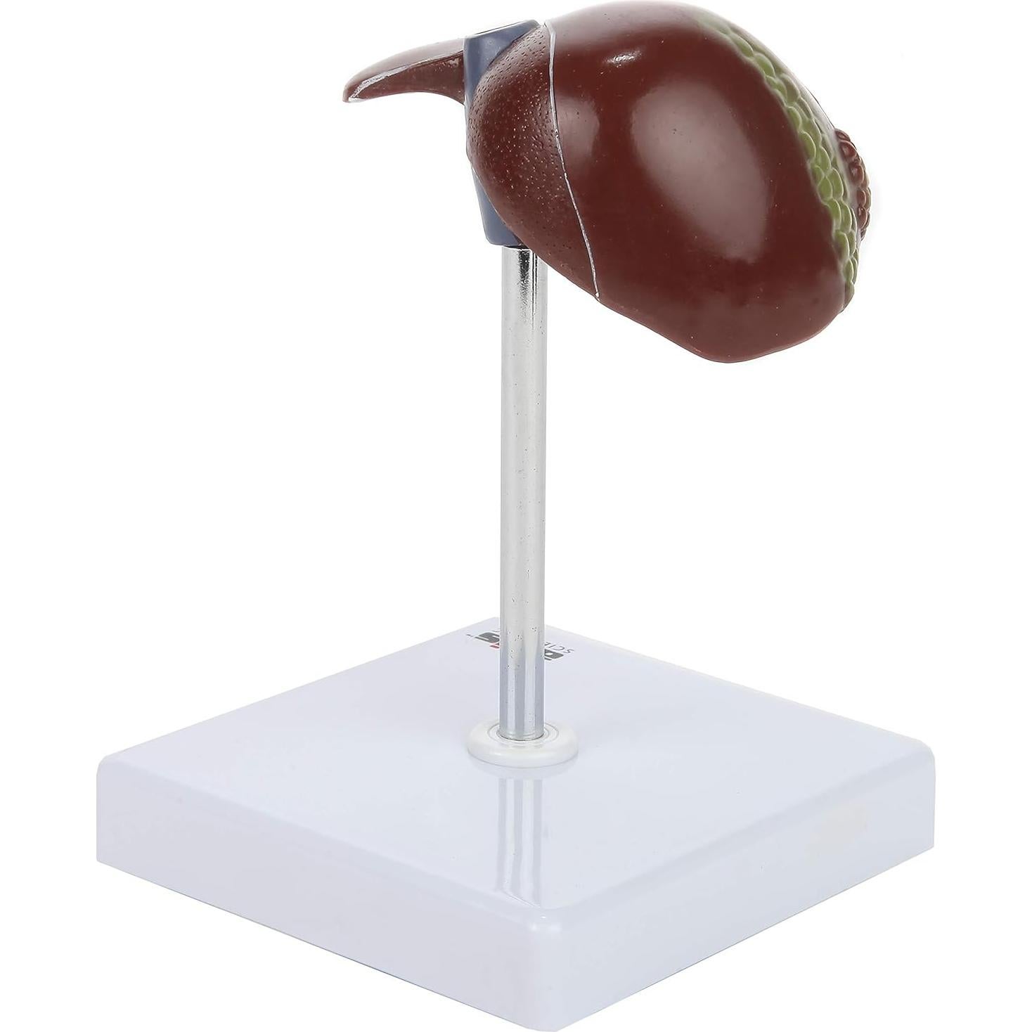 Axis Scientific Anatomy Model of Diseased Liver | Model is 1/3 Life-Size and Divides in 2 Parts | Shows 6 Liver Diseases and Abnormalities | Comes on a White Base