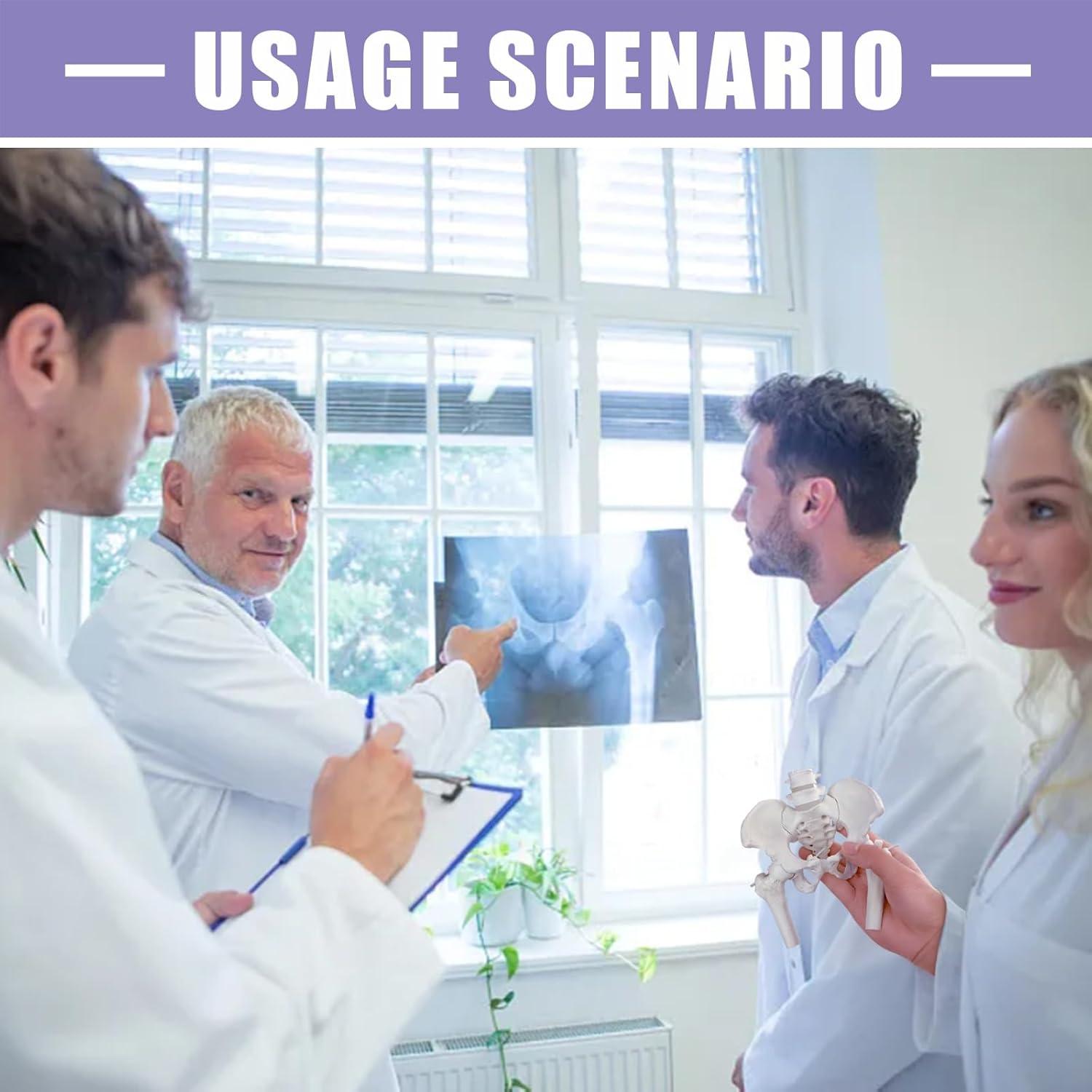 Modelo de Pelvis Femenina Merinden con Cabezas de Fémur Móviles