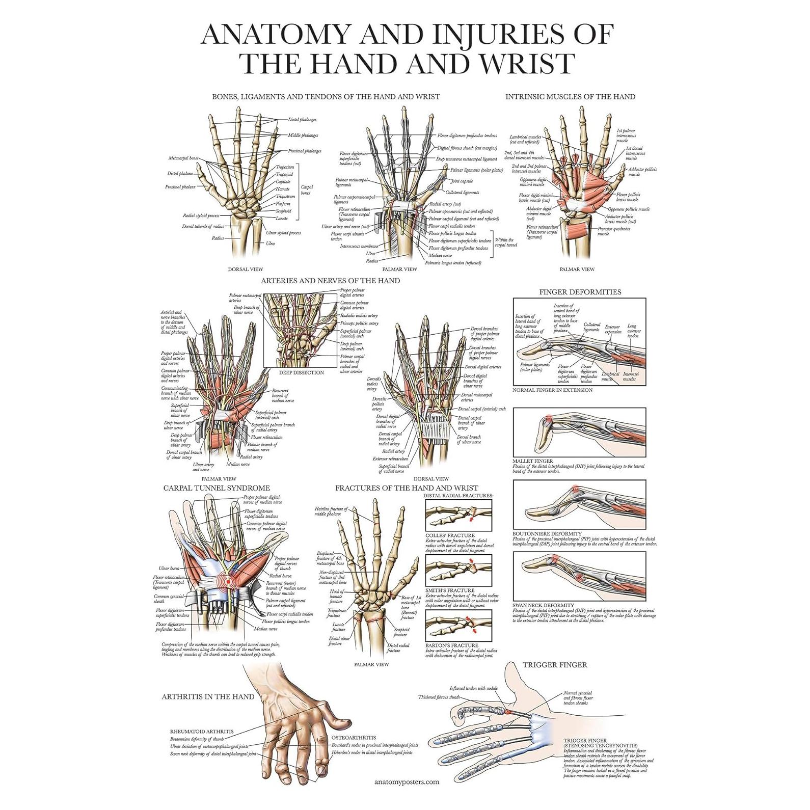 Póster Anatomía y Lesiones Mano y Muñeca Palace Learning 45.72x60.96 cm