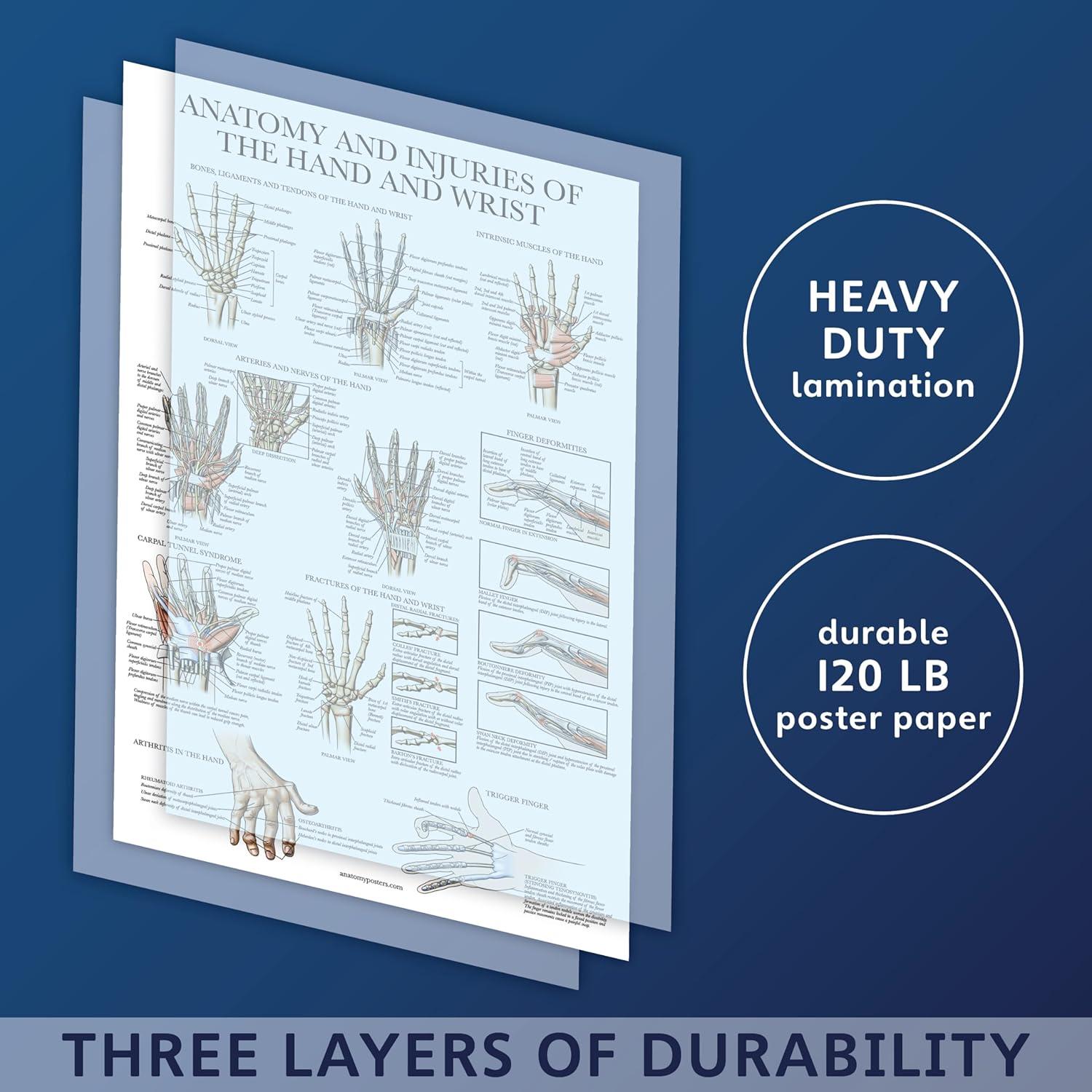Póster Anatomía y Lesiones Mano y Muñeca Palace Learning 45.72x60.96 cm