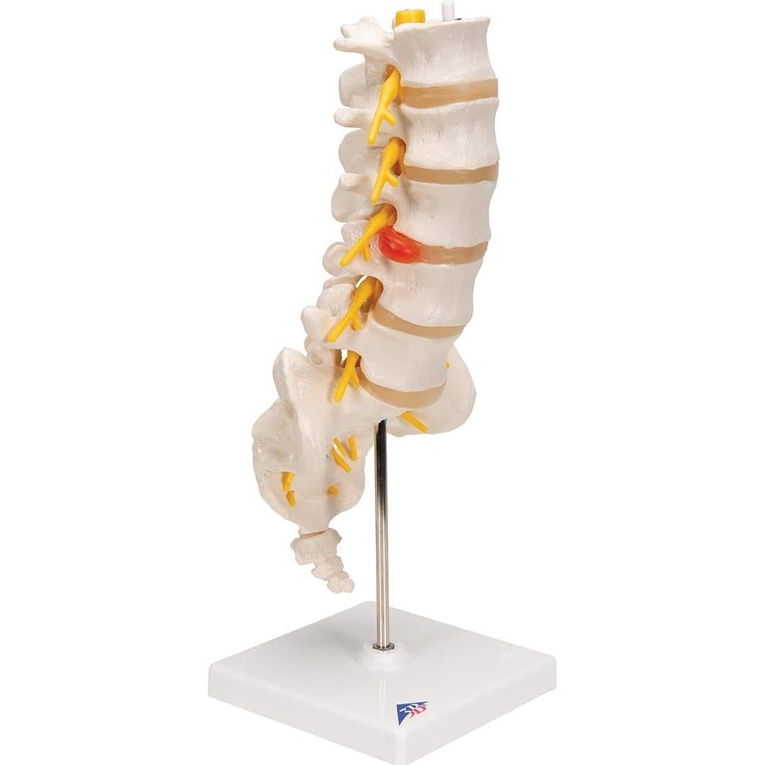 Columna Vertebral Lumbar 3B Scientific A76/5 con Disco Prolapsado 34 cm