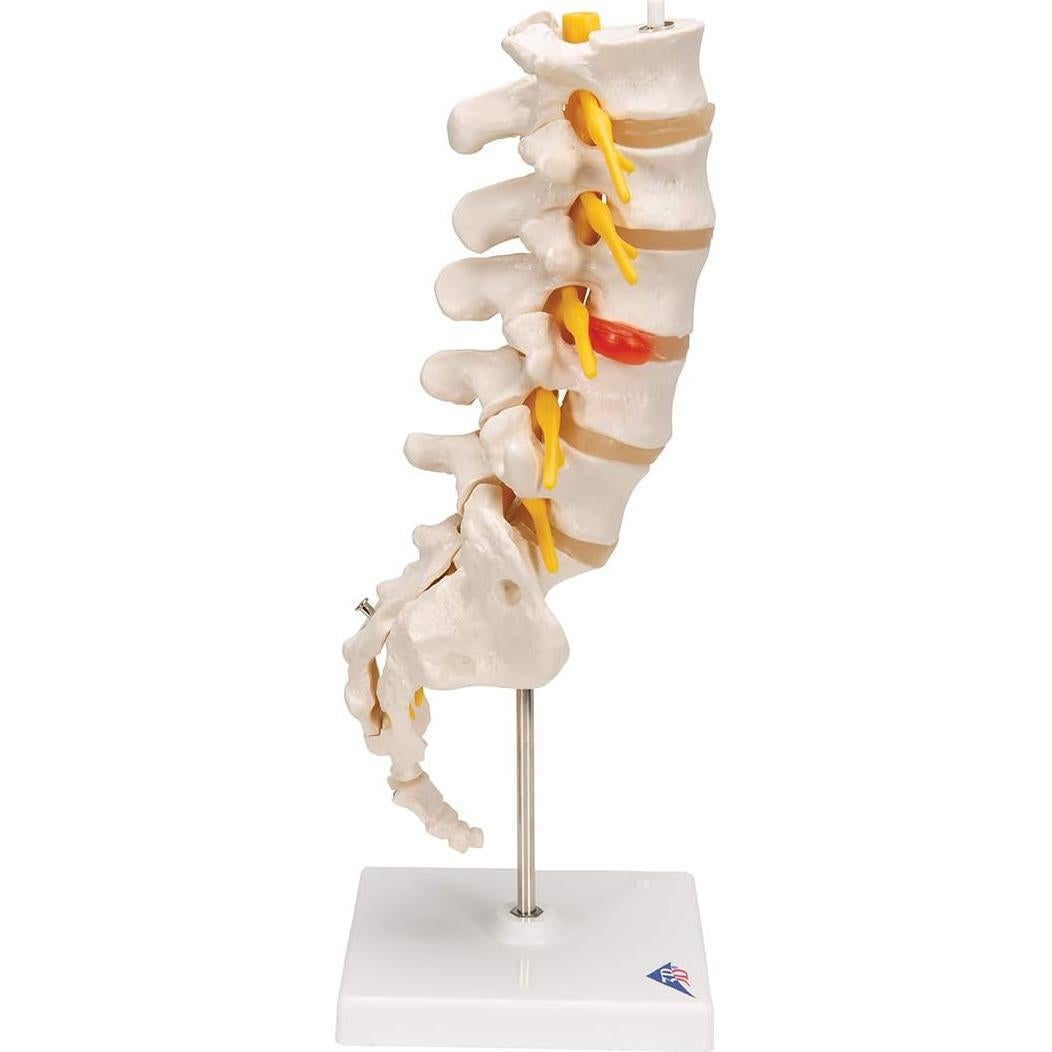 Columna Vertebral Lumbar 3B Scientific A76/5 con Disco Prolapsado 34 cm