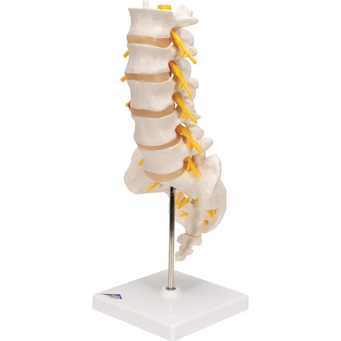 Columna Vertebral Lumbar 3B Scientific A76/5 con Disco Prolapsado 34 cm
