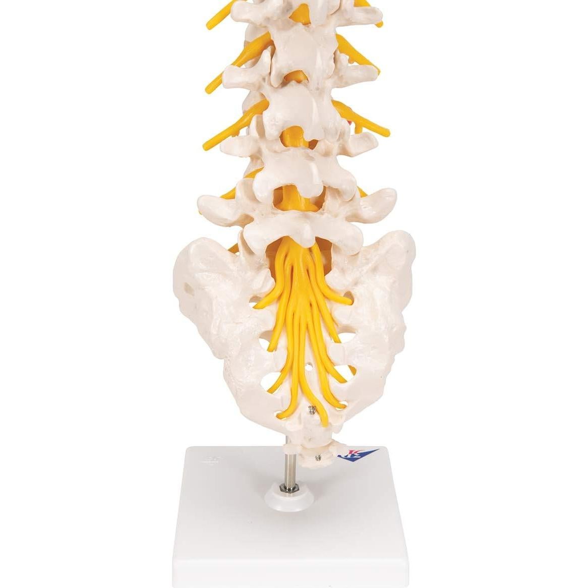 Columna Vertebral Lumbar 3B Scientific A76/5 con Disco Prolapsado 34 cm
