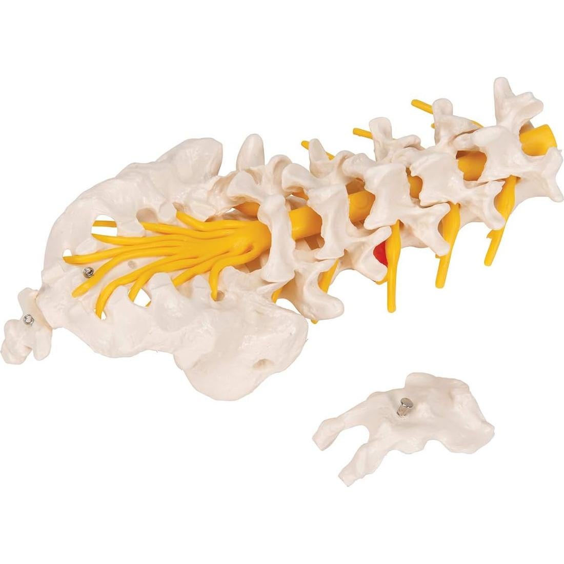 Columna Vertebral Lumbar 3B Scientific A76/5 con Disco Prolapsado 34 cm