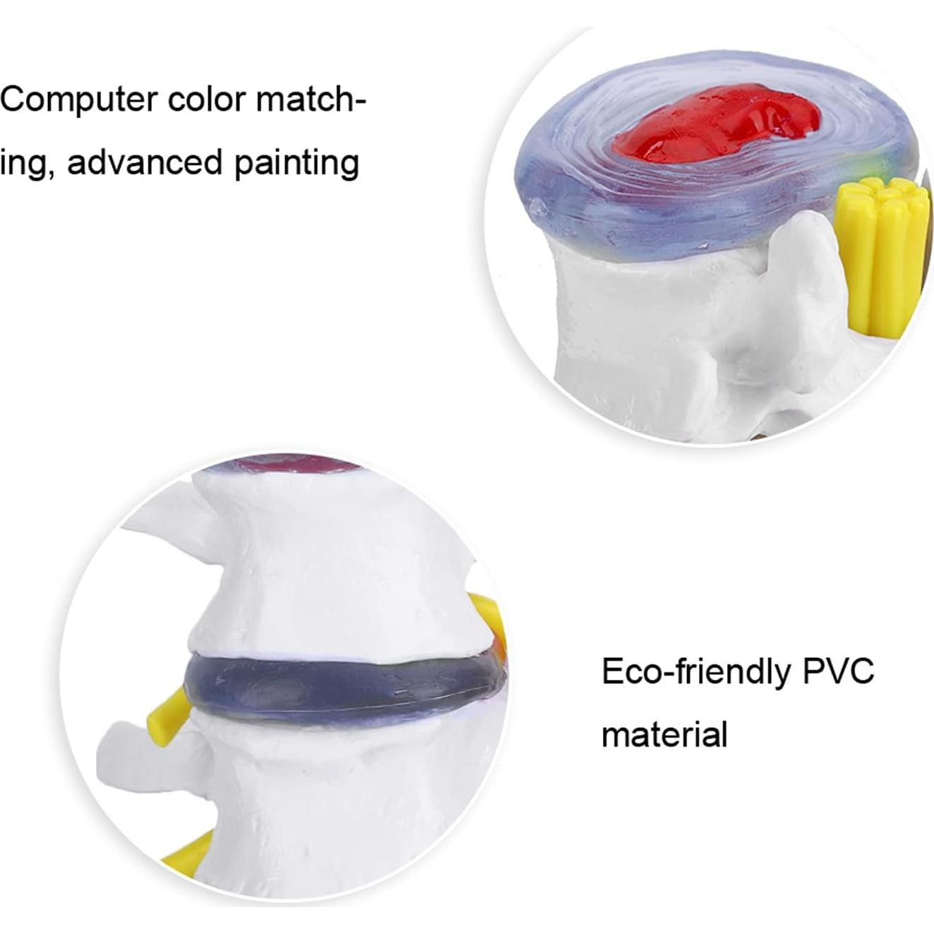 Modelo de Columna Vertebral YUYTE con Hernia de Disco Lumbar