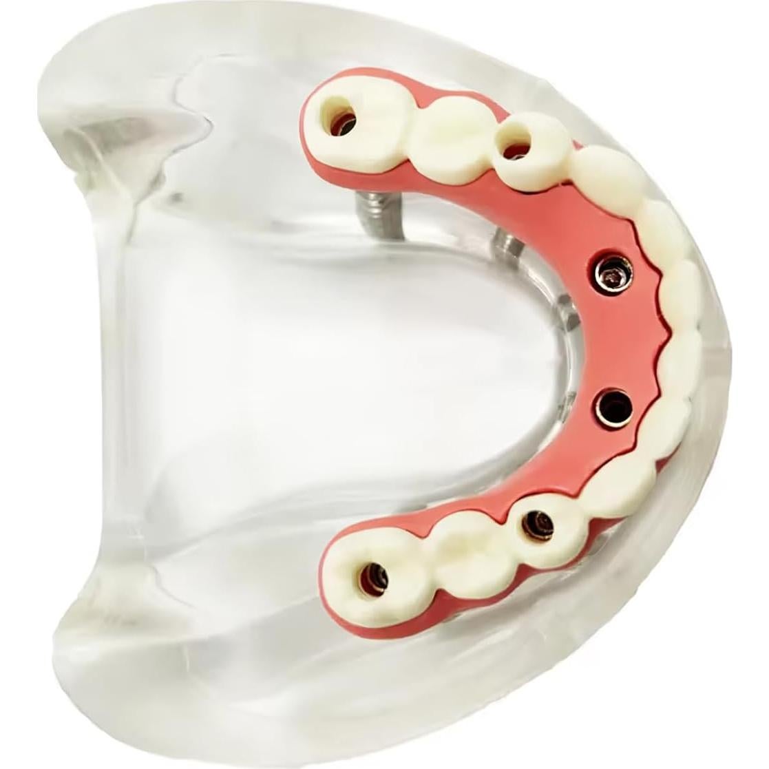 Modelo de Sobredentadura Dental Inferior Tangshan 7x6cm