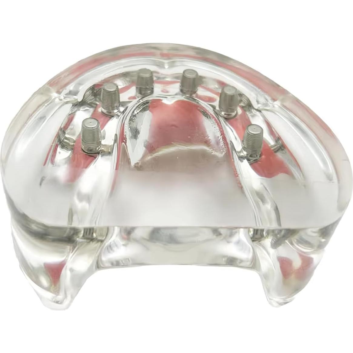 Modelo de Sobredentadura Dental Inferior Tangshan 7x6cm