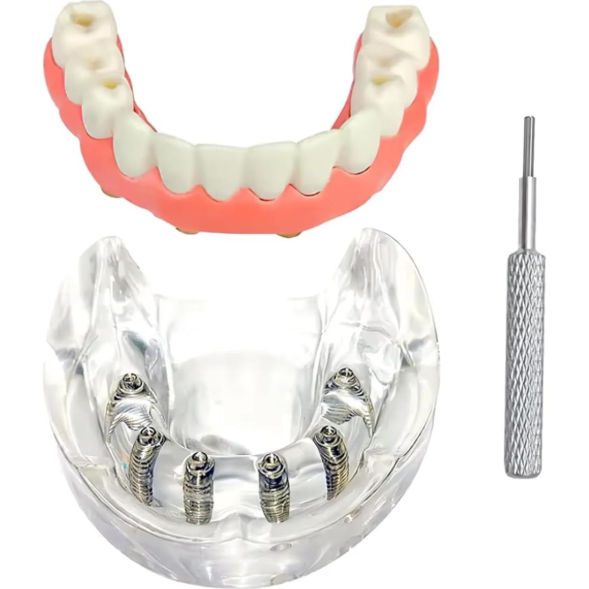 Modelo de Sobredentadura Dental Inferior Tangshan 7x6cm
