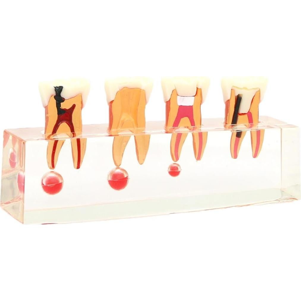 Modelo de Diente 4018 XINGXING Tratamiento Endodóntico 4 Etapas