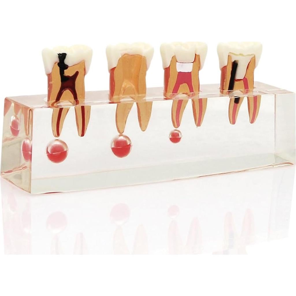 Modelo de Diente 4018 XINGXING Tratamiento Endodóntico 4 Etapas