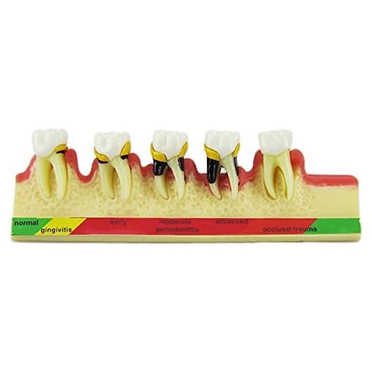 Modelo Typodont de Dientes Periodontales Airgoesin - Nuevo