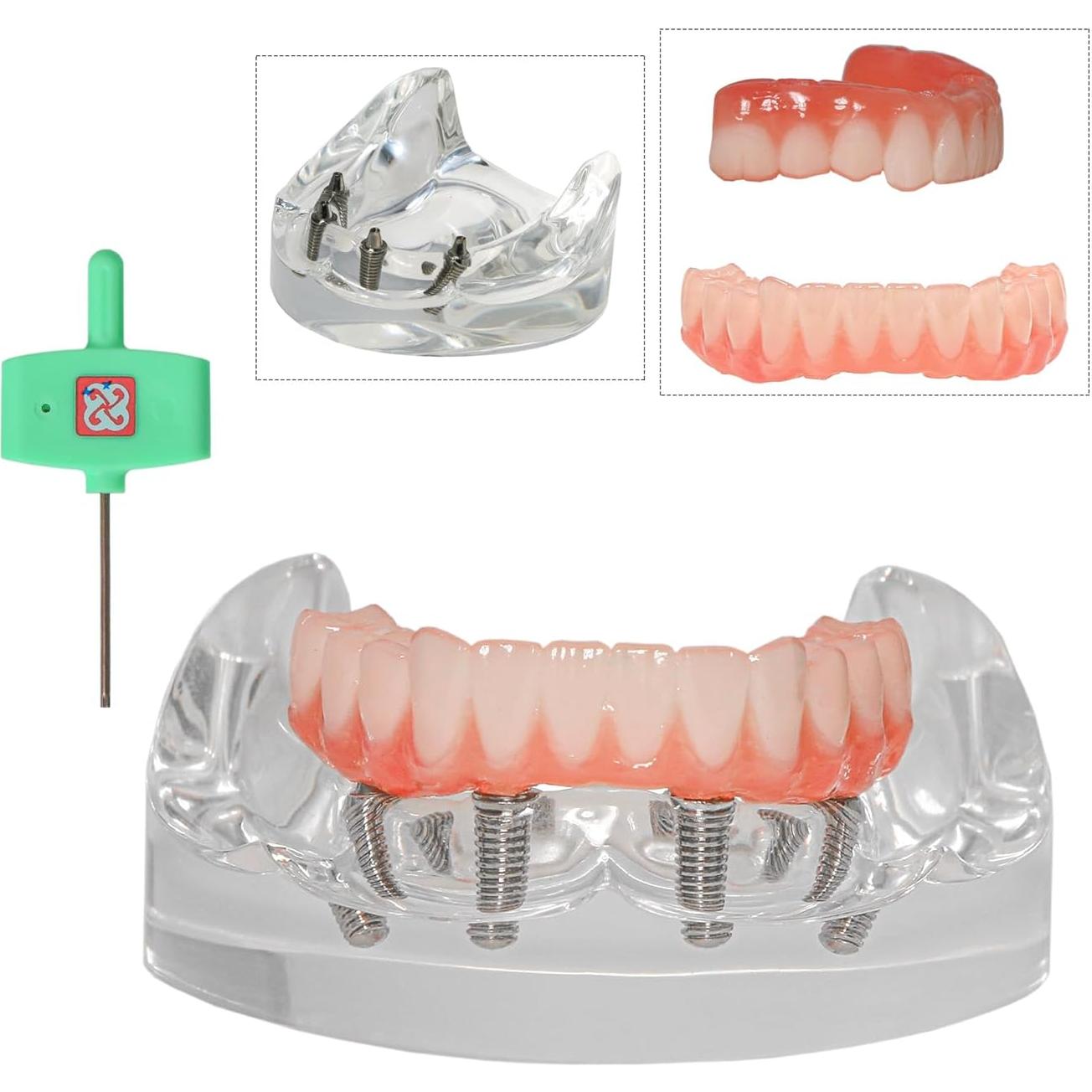 Modelo de Implante Dental Typodont Transparente All-on-4