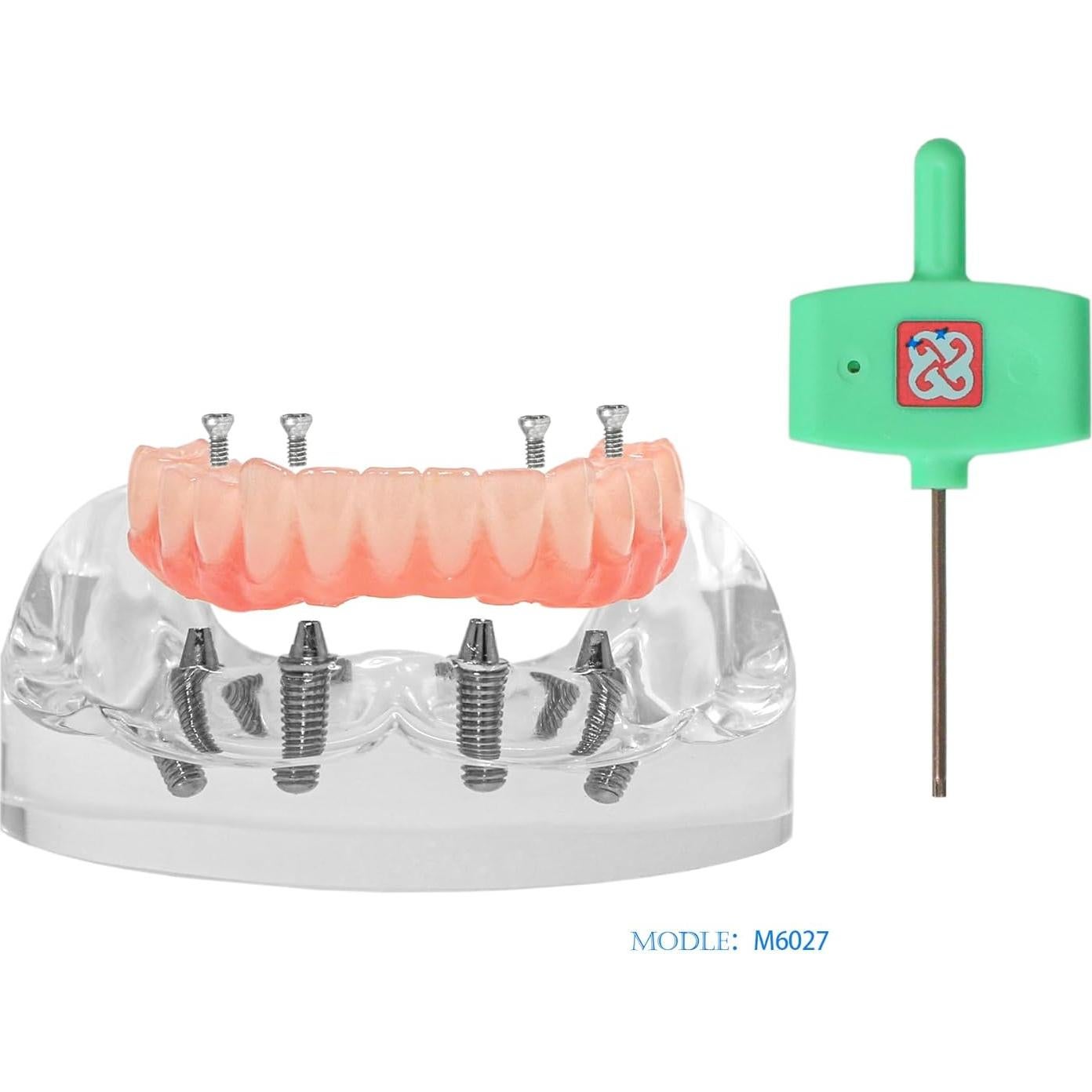 Modelo de Implante Dental Typodont Transparente All-on-4