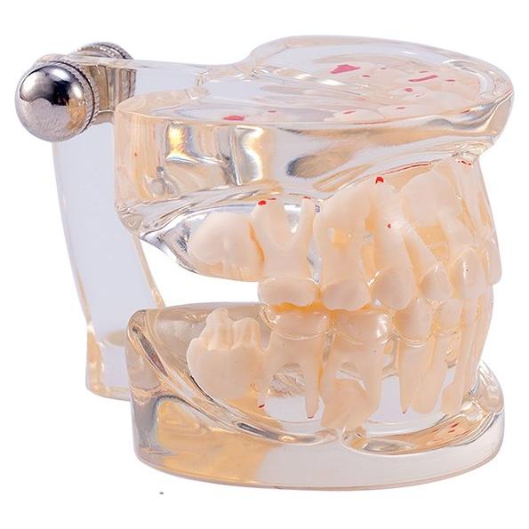 Modelo Dental Pediátrico Easyinsmile TC6 Resina Transparente