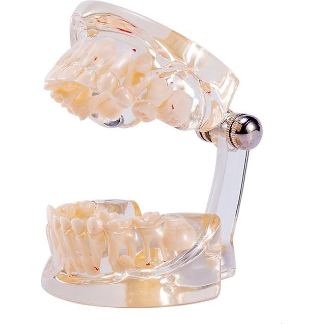 Modelo Dental Pediátrico Easyinsmile TC6 Resina Transparente