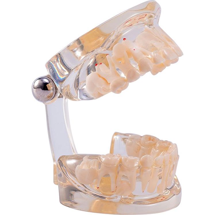 Modelo Dental Pediátrico Easyinsmile TC6 Resina Transparente