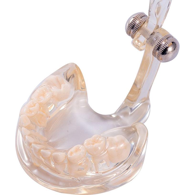 Modelo Dental Pediátrico Easyinsmile TC6 Resina Transparente