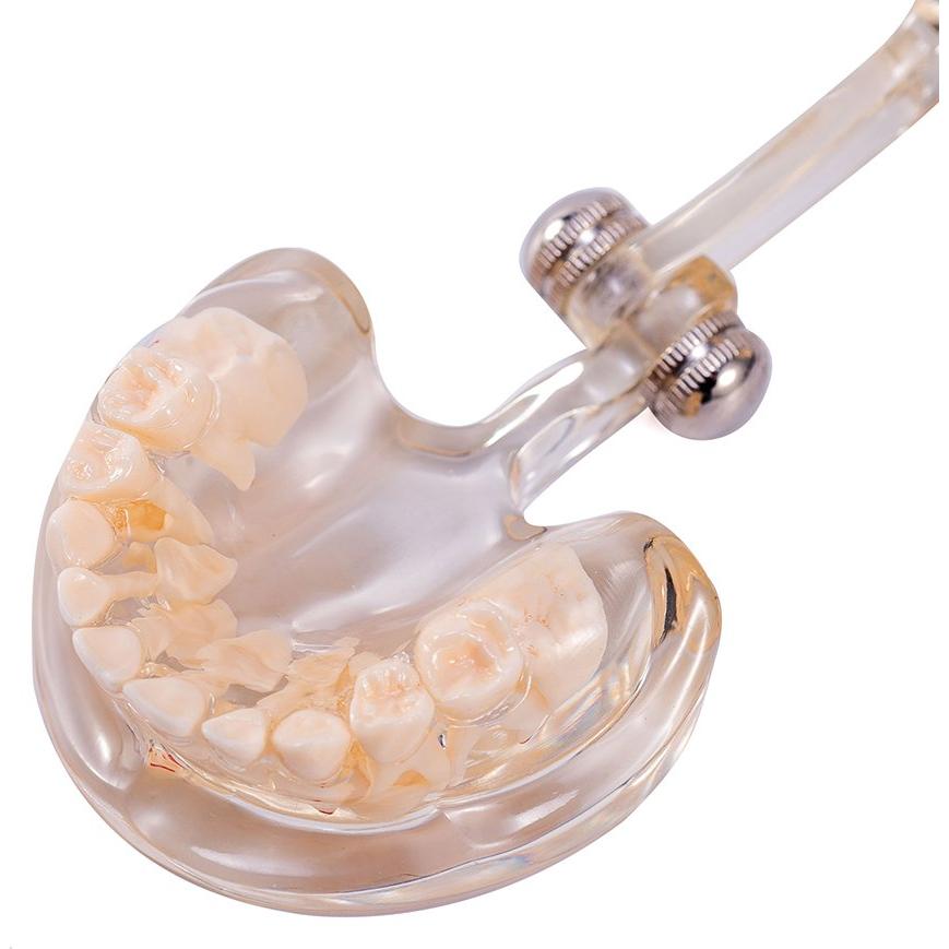 Modelo Dental Pediátrico Easyinsmile TC6 Resina Transparente