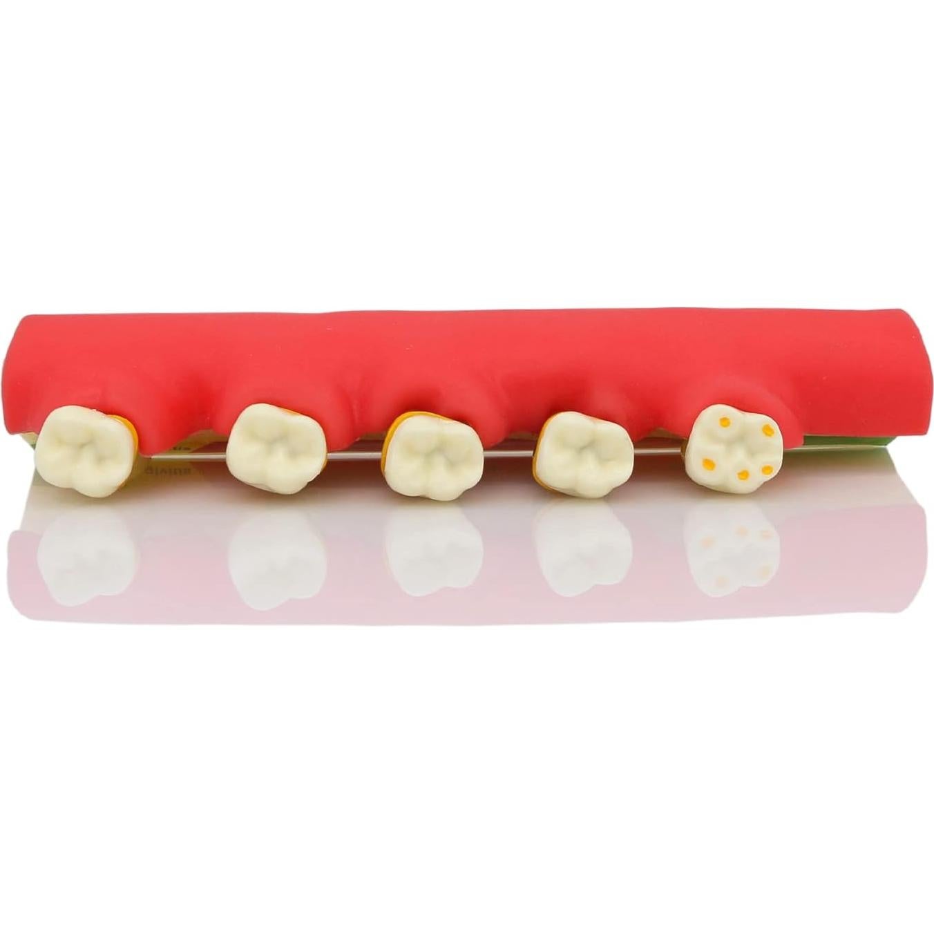 Modelo Typodont Dentalmall 4010 para Enfermedad Periodontal