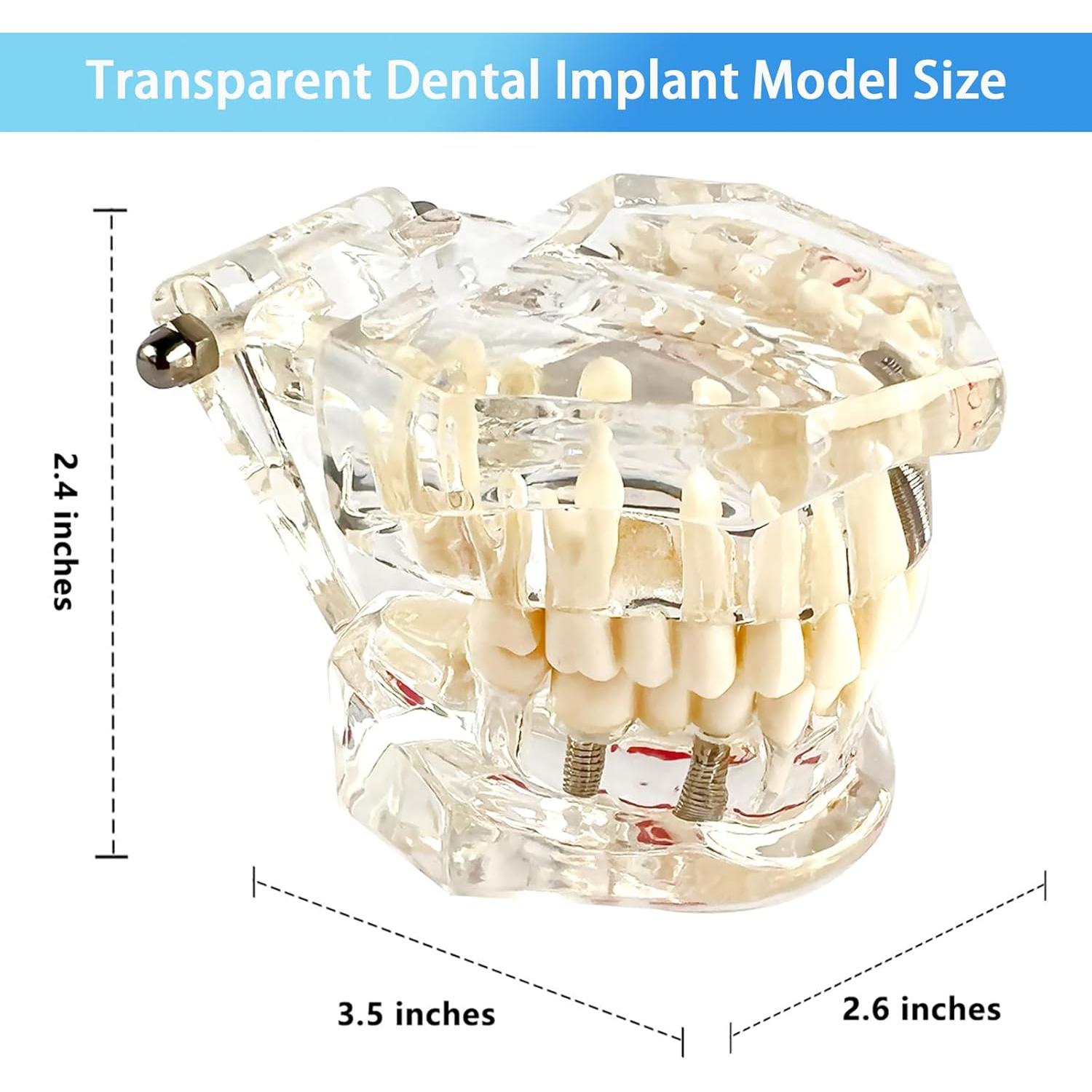 Modelo Dental Transparente Patológico Ceonam - Tamaño Real