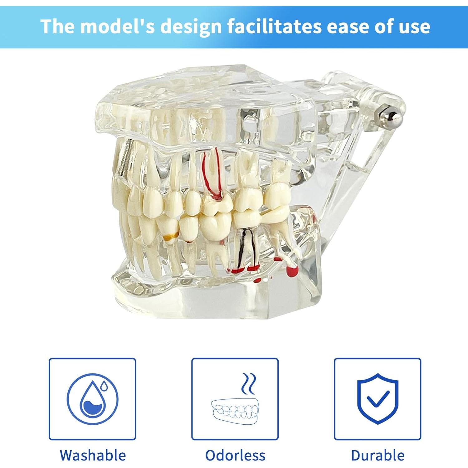 Modelo Dental Transparente Patológico Ceonam - Tamaño Real
