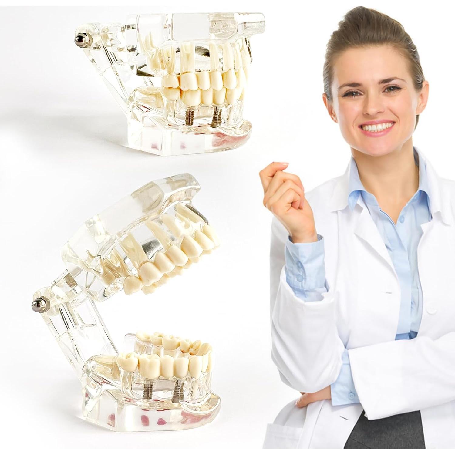 Modelo Dental Transparente Patológico Ceonam - Tamaño Real