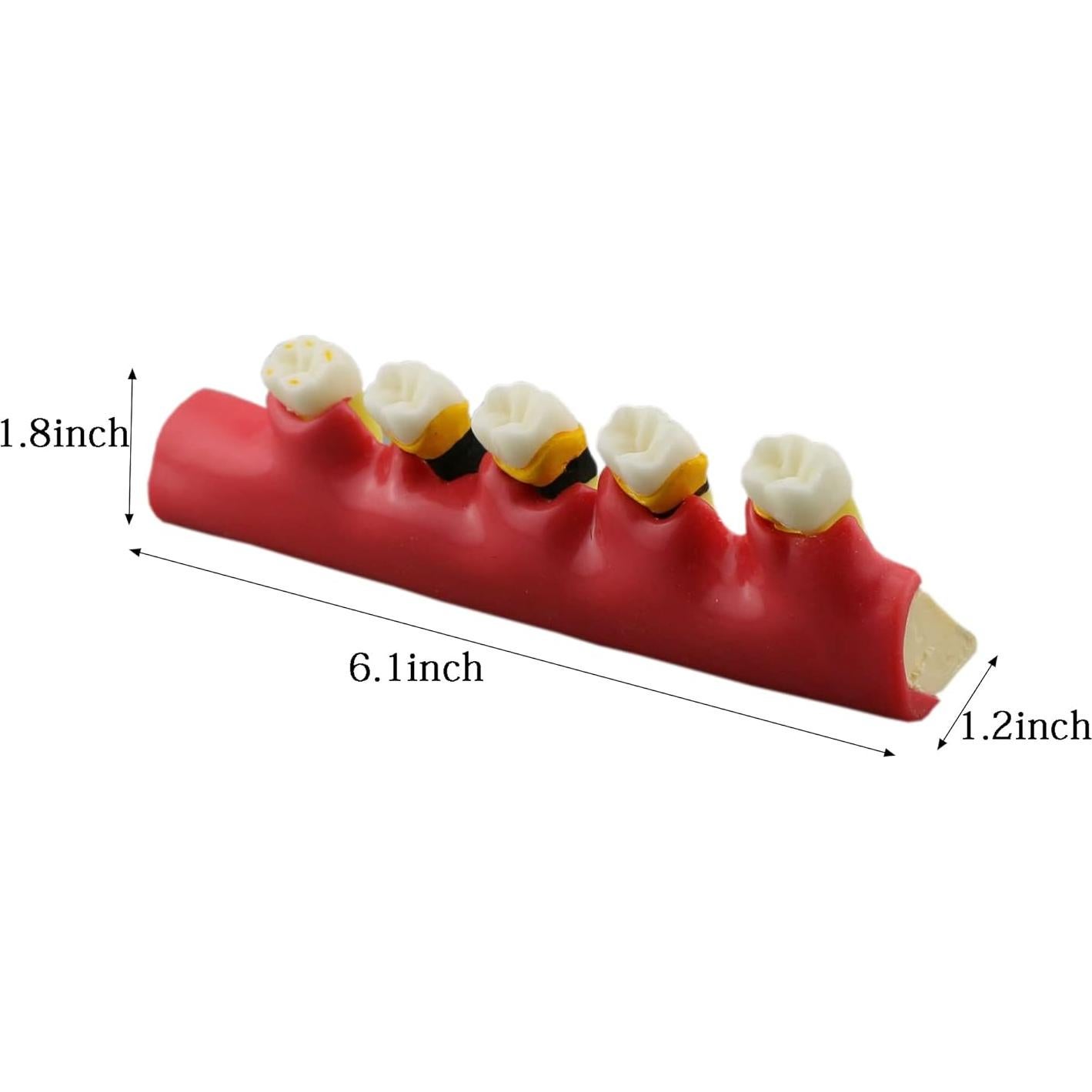 Modelo Typodont Dental M4010 para Enfermedad Periodontal