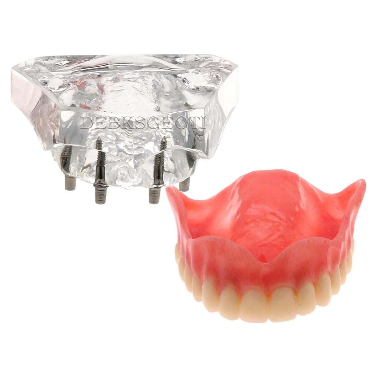Modelo Typodont de Dientes de Implante Dental M6001 Claro