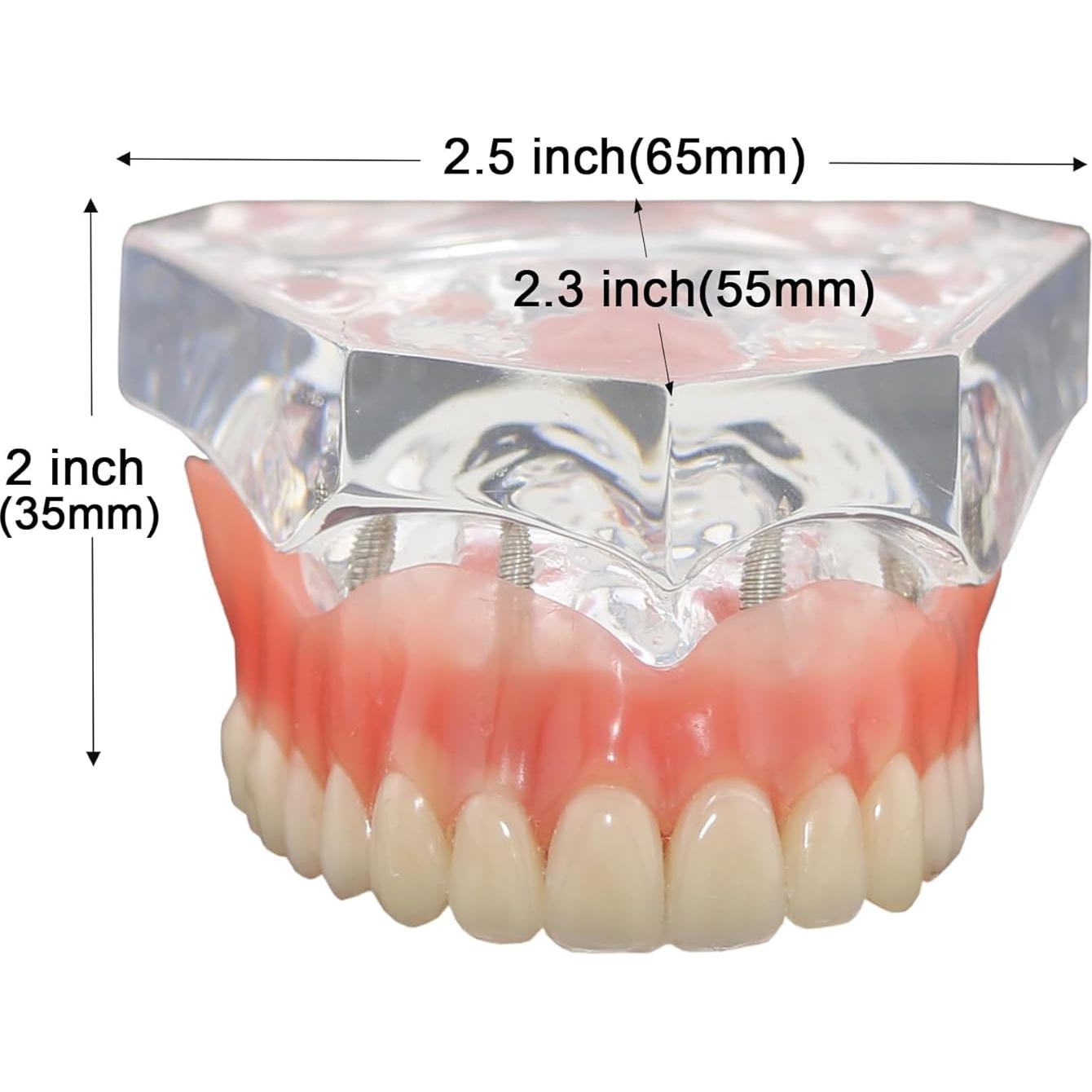 Modelo Typodont de Dientes de Implante Dental M6001 Claro