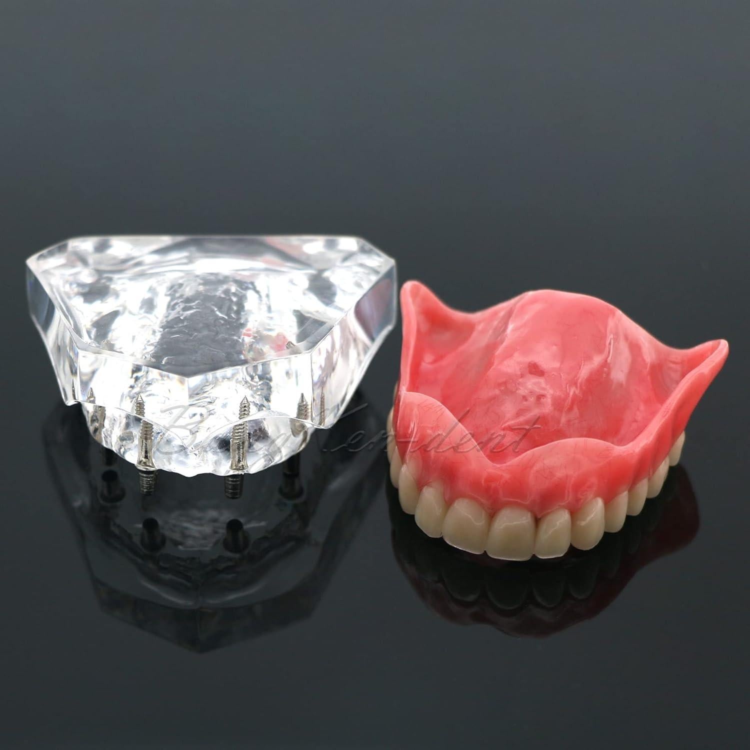 Modelo Typodont de Dientes de Implante Dental M6001 Claro