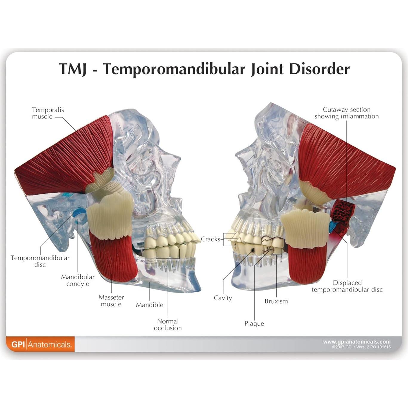 Modelo de Articulación Temporomandibular GPI Anatomicals 15cm