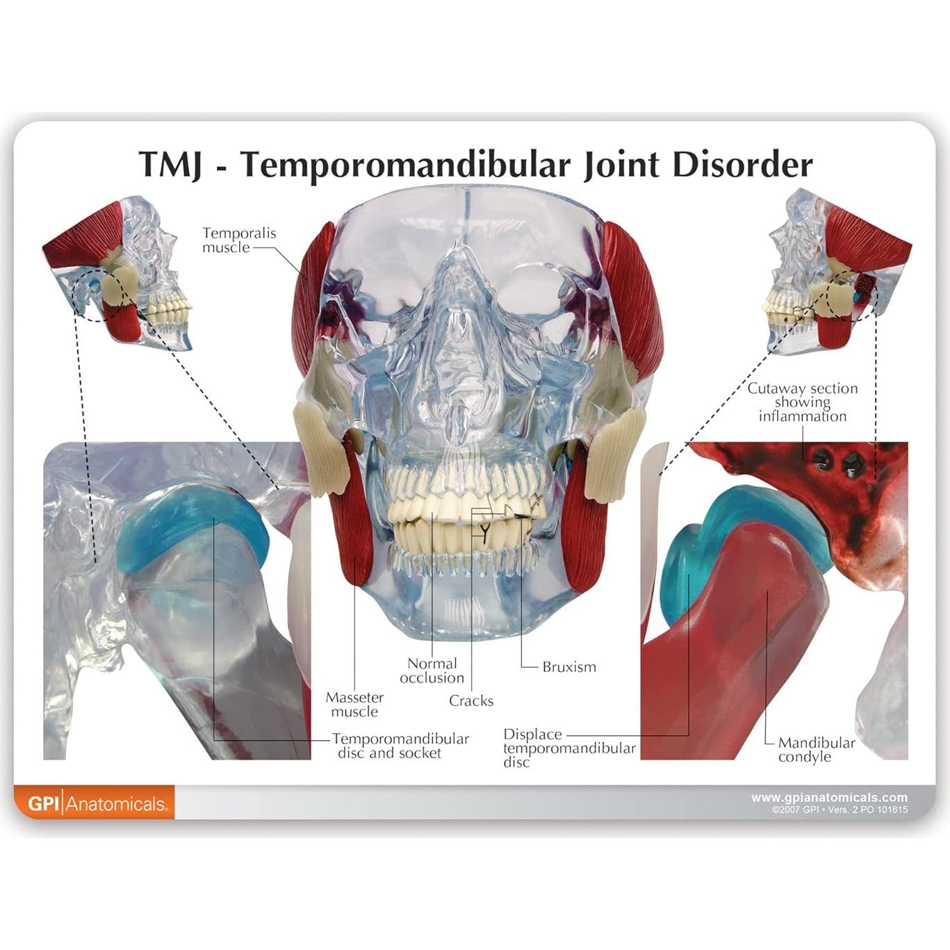 Modelo de Articulación Temporomandibular GPI Anatomicals 15cm
