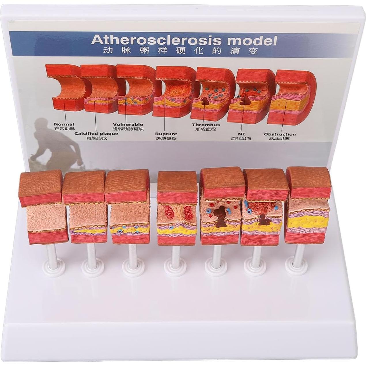 Modelo de Anatomía Arterial 7 Piezas LUCKDANO PVC Educativo