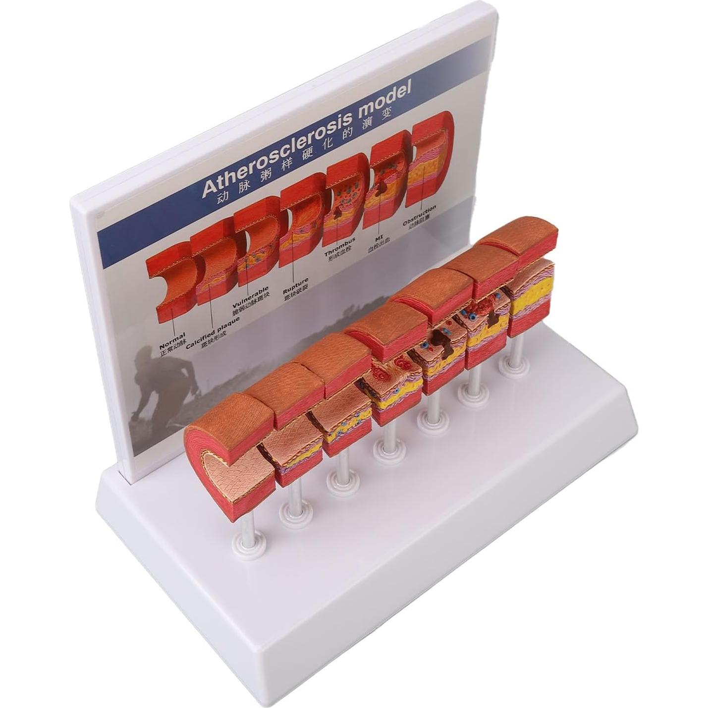 Modelo de Anatomía Arterial 7 Piezas LUCKDANO PVC Educativo