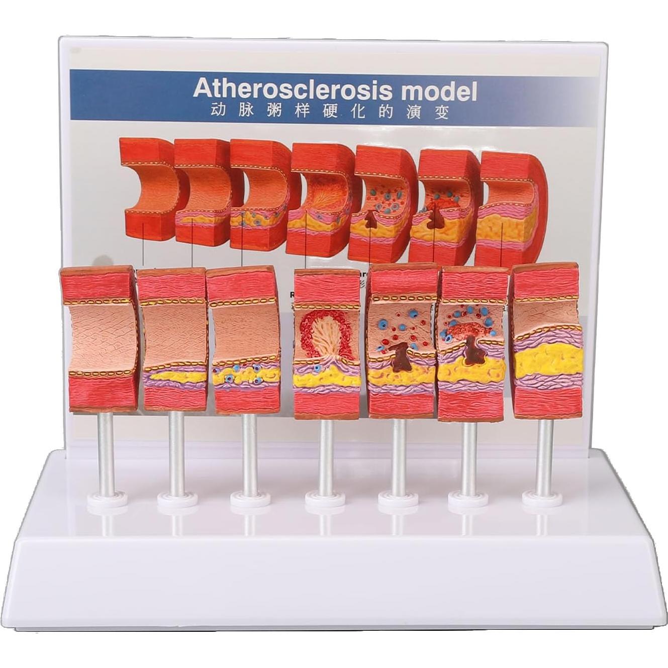 Modelo de Anatomía Arterial 7 Piezas LUCKDANO PVC Educativo