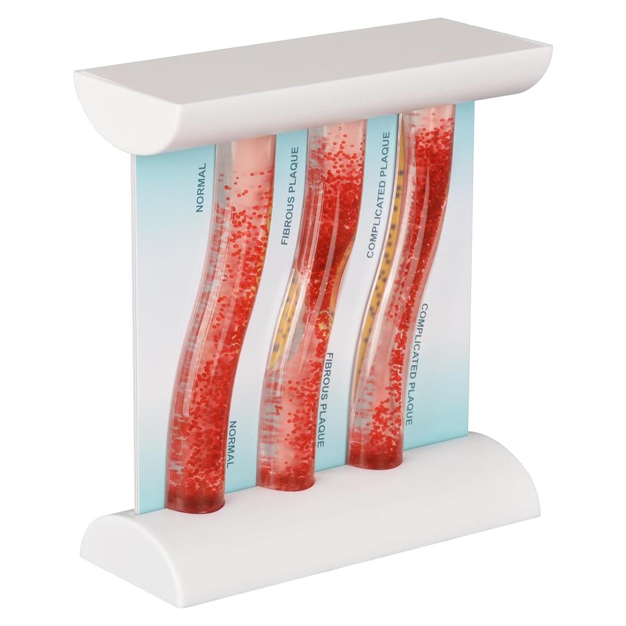 Modelo de vaso sanguíneo LDL SimCoach para enseñanza médica