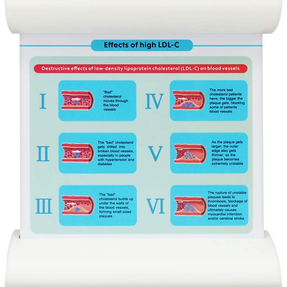 Modelo de vaso sanguíneo LDL SimCoach para enseñanza médica