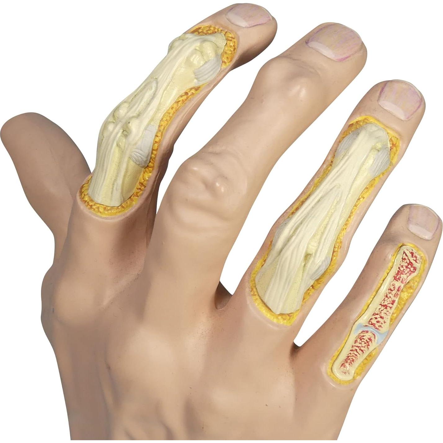 Modelo de Mano Derecha con Osteoartritis GPI Anatomicals