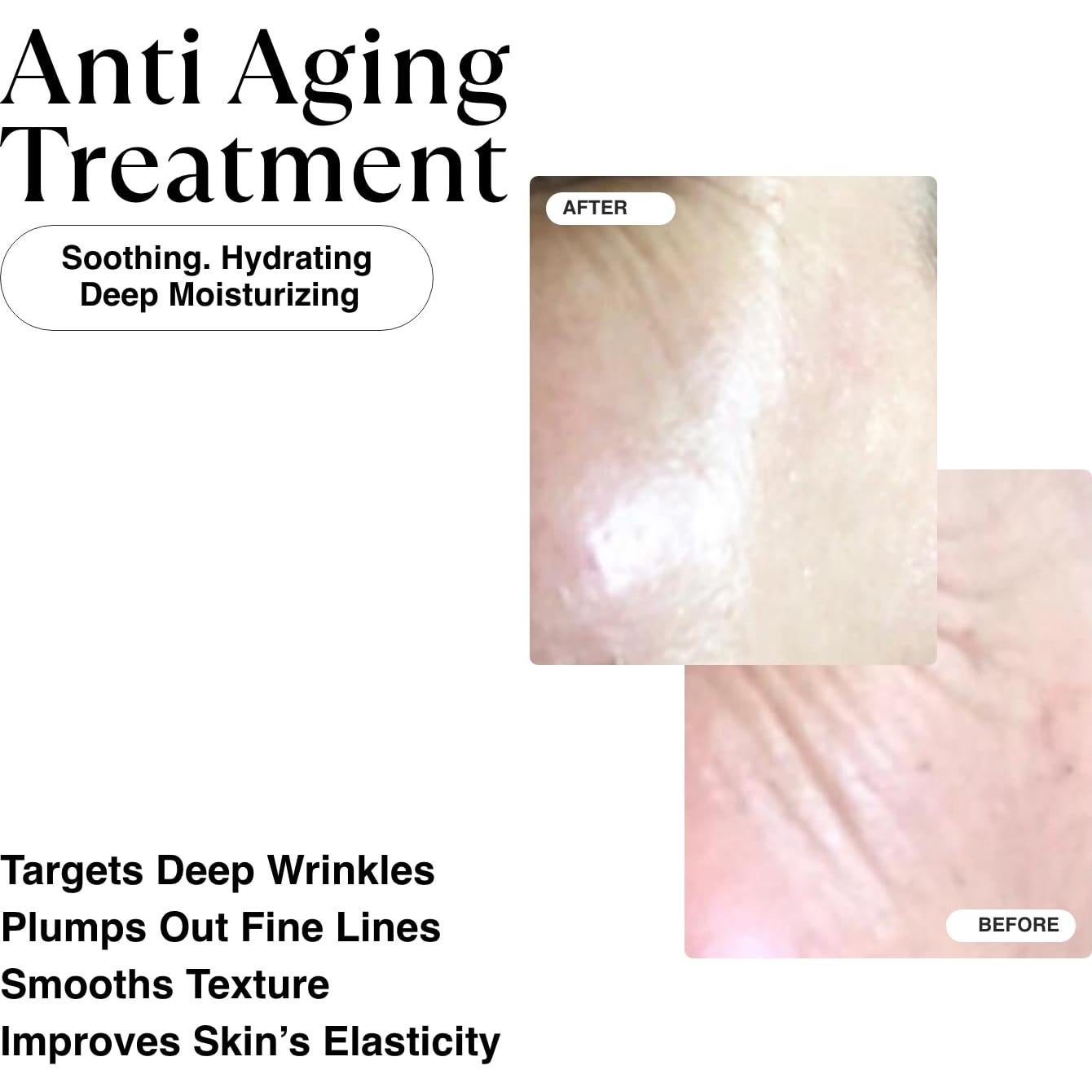 Crema Nocturna Hidratante Matkas Coreana 0.05% Retinaldehído 50ml