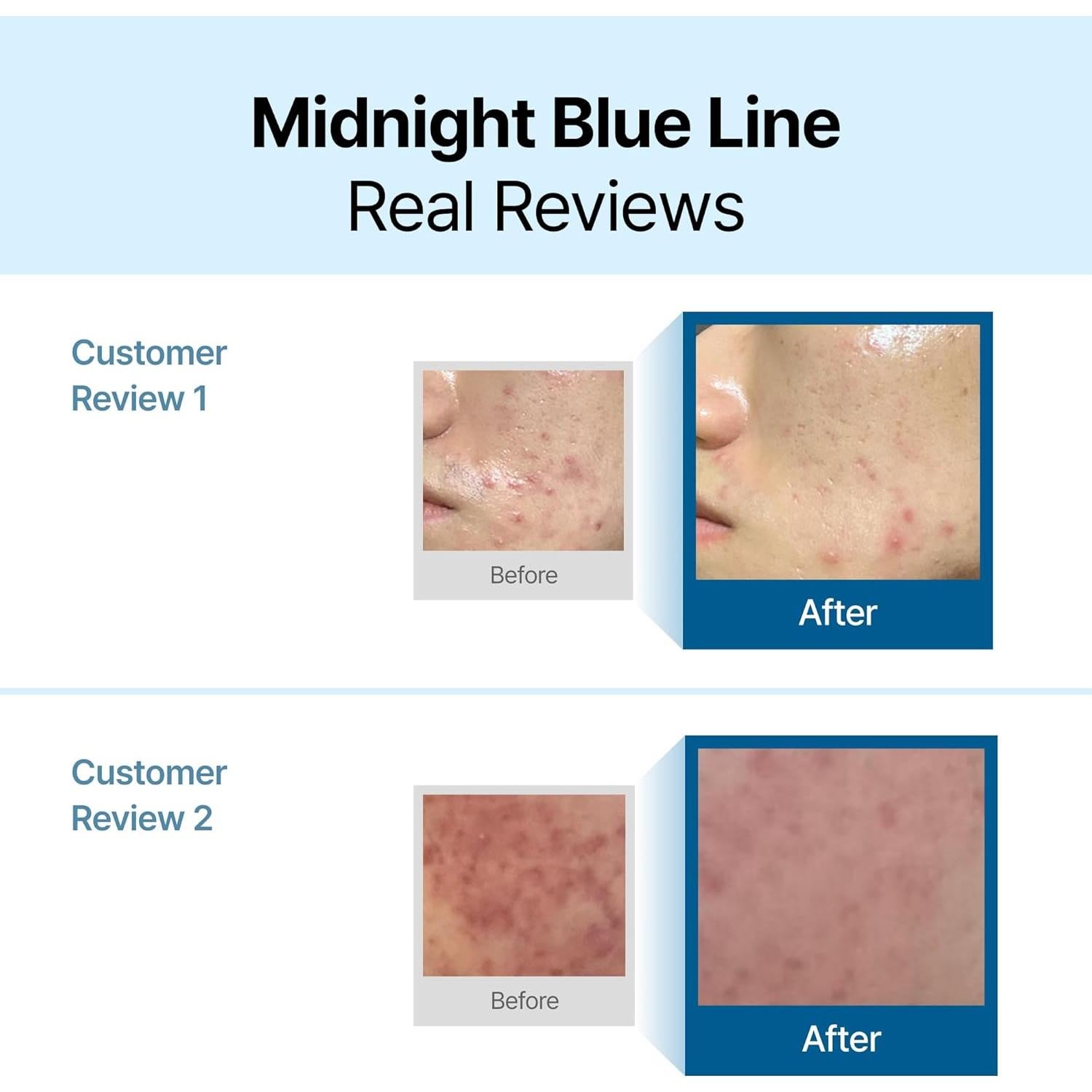 Crema Calmante Facial DearKlairs 59.15 ml - Hidratante Piel Grasa