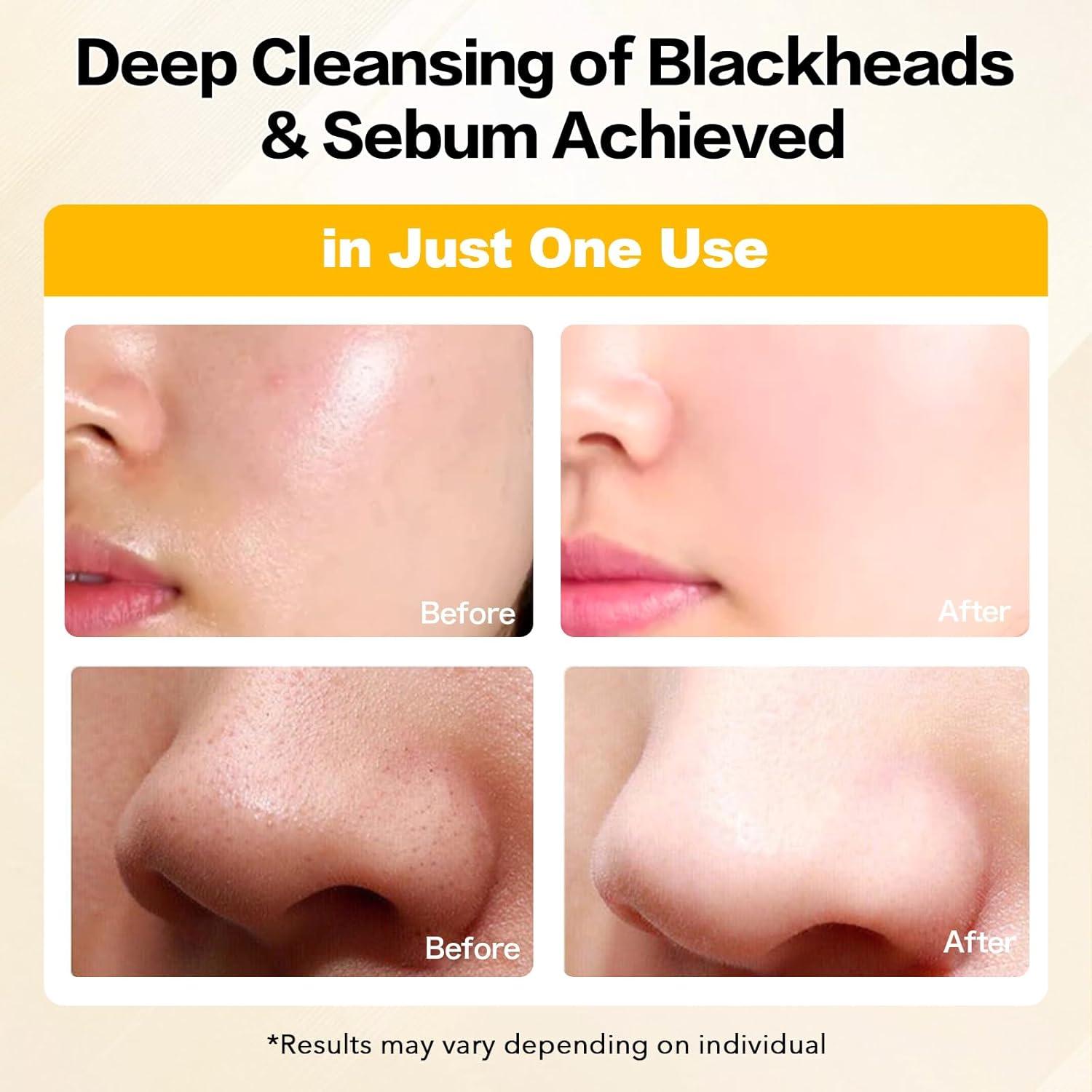 Aceite Limpiador Profundo NAILKISS 200ML Control de Poros