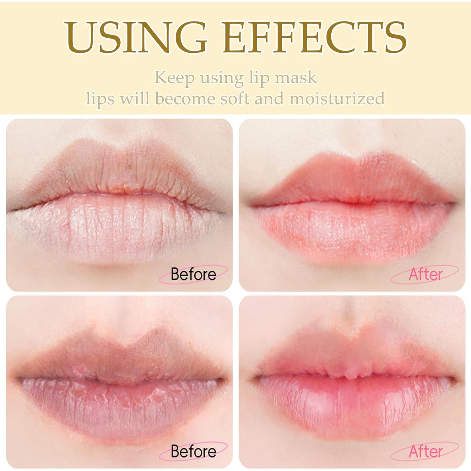 30 Mascarillas Hidratantes de Gel Minfei para Labios y Ojos