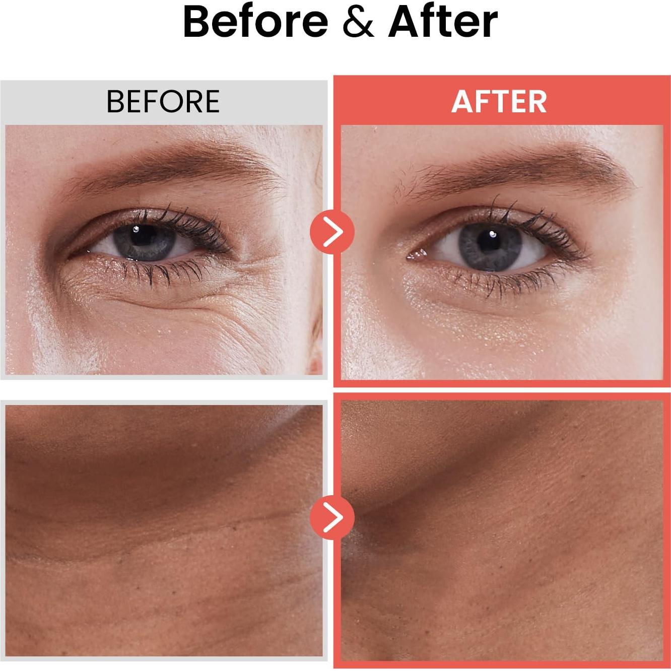 Suero Supremo para Arrugas SKIN HOUSE 20ml Ginseng Rojo